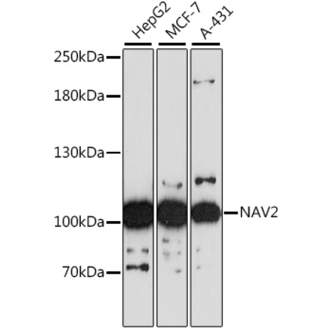 NAV2 Rabbit Polyclonal Antibody