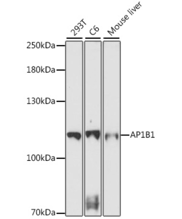 AP1B1 Rabbit Polyclonal Antibody