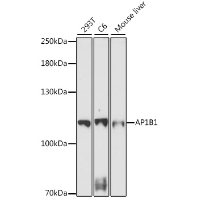 AP1B1 Rabbit Polyclonal Antibody
