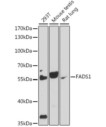 FADS1 Rabbit Polyclonal Antibody