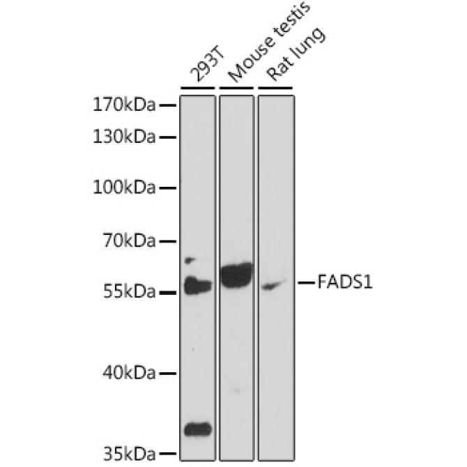 FADS1 Rabbit Polyclonal Antibody