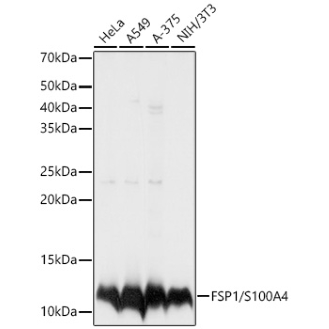 FSP1/S100A4 Rabbit Polyclonal Antibody