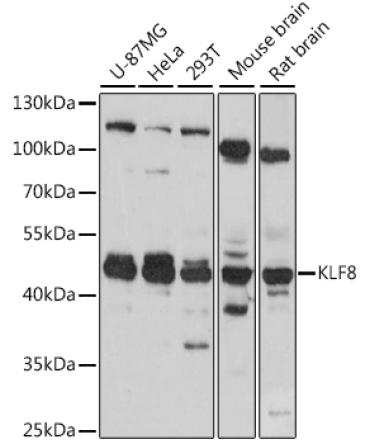 KLF8 Rabbit Polyclonal Antibody