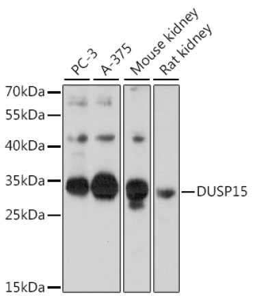 DUSP15 Rabbit Polyclonal Antibody
