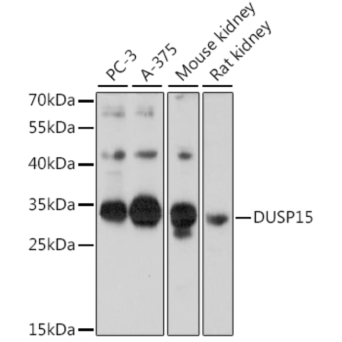 DUSP15 Rabbit Polyclonal Antibody