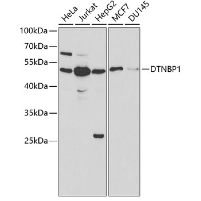 DTNBP1 Rabbit Polyclonal Antibody