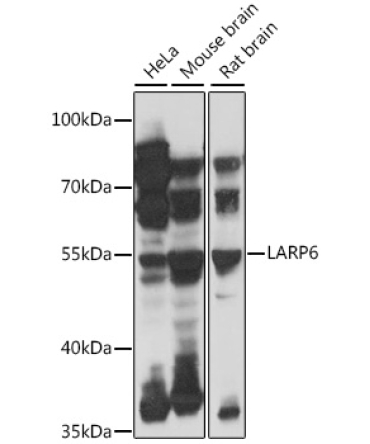 LARP6 Rabbit Polyclonal Antibody