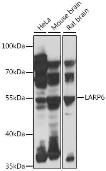 LARP6 Rabbit Polyclonal Antibody