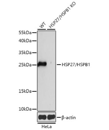 HSP27/HSPB1 Rabbit Polyclonal Antibody [KO Validated]
