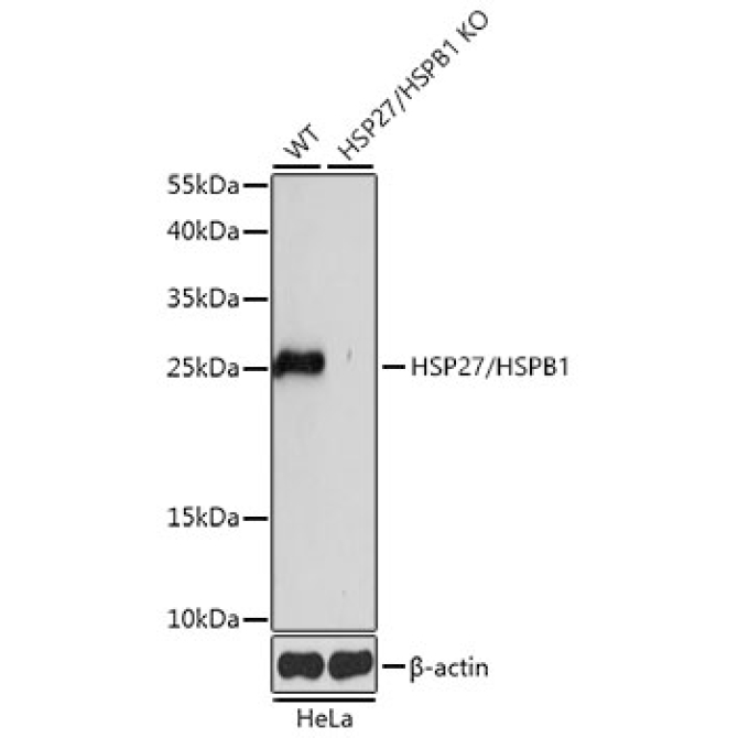 HSP27/HSPB1 Rabbit Polyclonal Antibody [KO Validated]