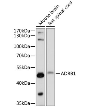 ADRB1 Rabbit Polyclonal Antibody