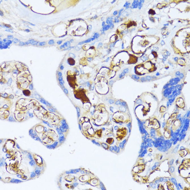 Alpha-2-Macroglobulin (A2M) Rabbit Polyclonal Antibody