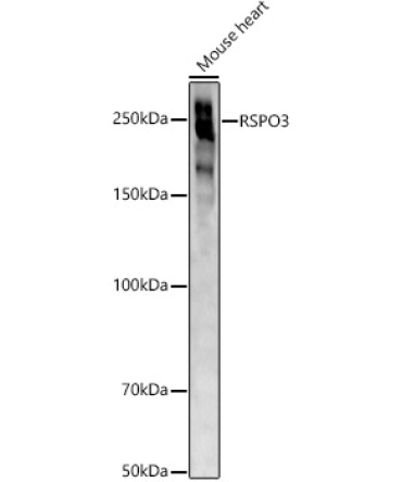 ABCA1 Rabbit Polyclonal Antibody