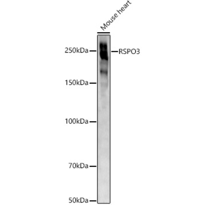ABCA1 Rabbit Polyclonal Antibody