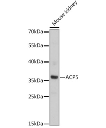 ACP5 Rabbit Polyclonal Antibody