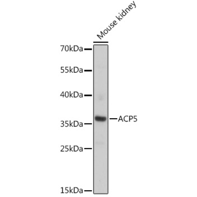 ACP5 Rabbit Polyclonal Antibody