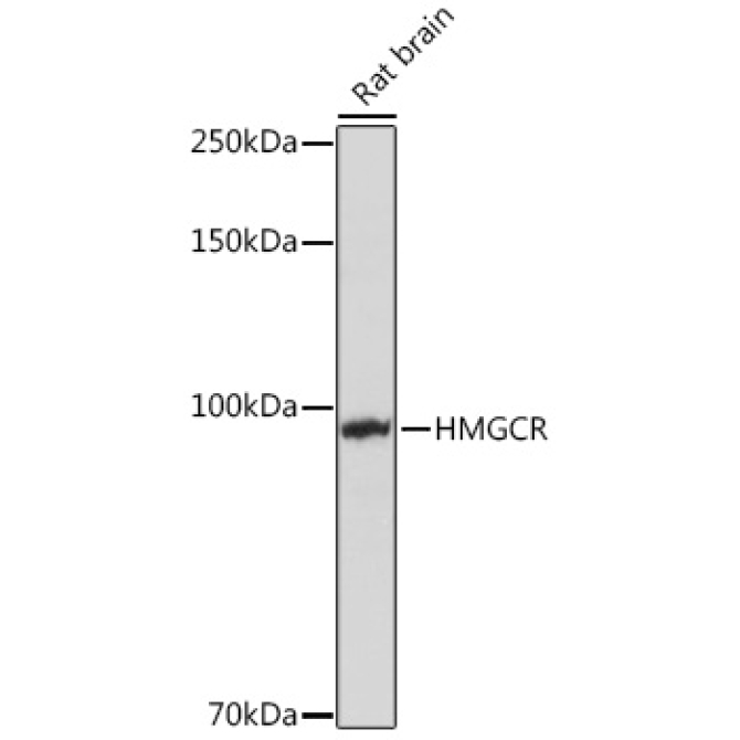 HMGCR Rabbit Polyclonal Antibody