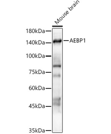 AEBP1 Rabbit Polyclonal Antibody