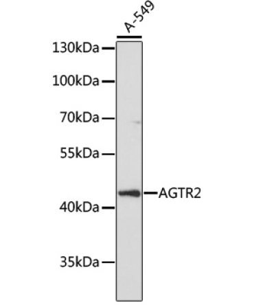 AGTR2 Rabbit Polyclonal Antibody