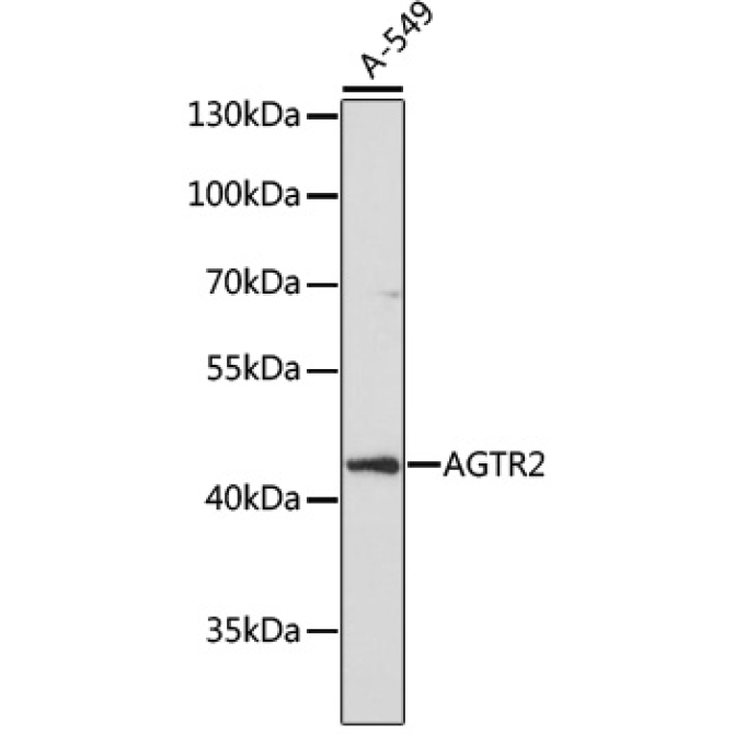 AGTR2 Rabbit Polyclonal Antibody