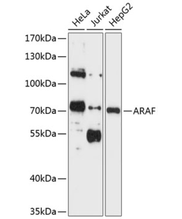 ARAF Rabbit Polyclonal Antibody