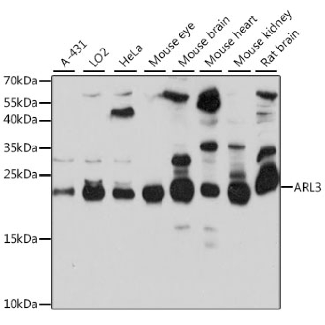 ARL3 Rabbit Polyclonal Antibody