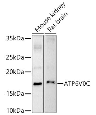 ATP6V0C Rabbit Polyclonal Antibody