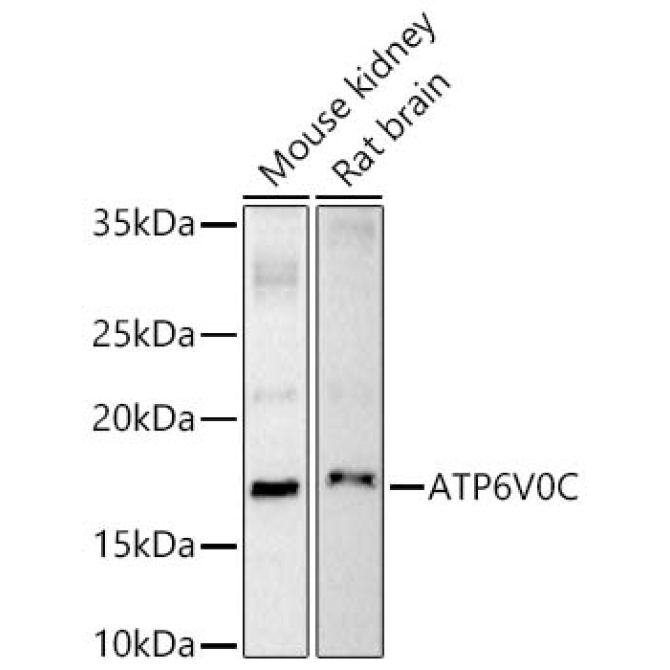 ATP6V0C Rabbit Polyclonal Antibody