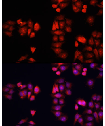 BMP1 Rabbit Polyclonal Antibody
