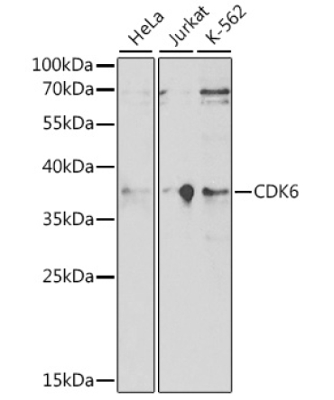 CDK6 Rabbit Polyclonal Antibody