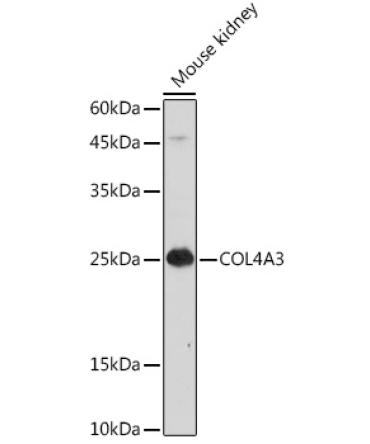 COL4A3 Rabbit Polyclonal Antibody