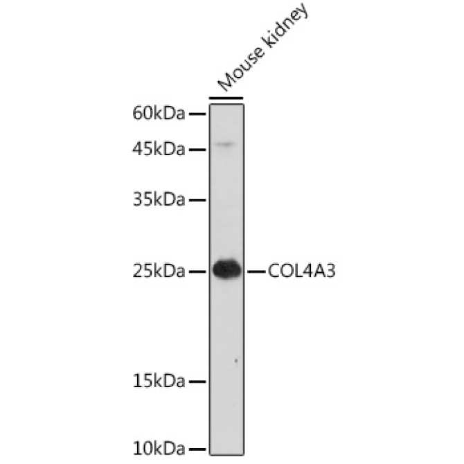 COL4A3 Rabbit Polyclonal Antibody
