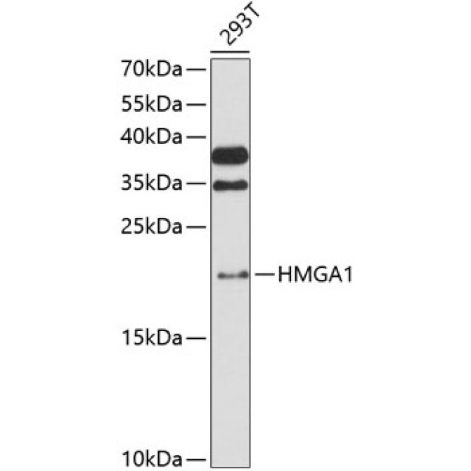 HMGA1 Rabbit Polyclonal Antibody