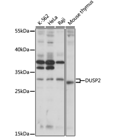DUSP2 Rabbit Polyclonal Antibody