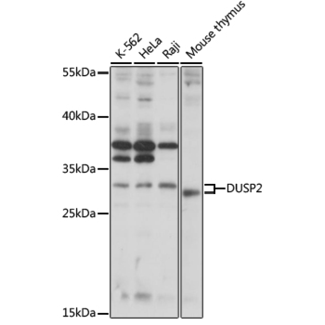 DUSP2 Rabbit Polyclonal Antibody