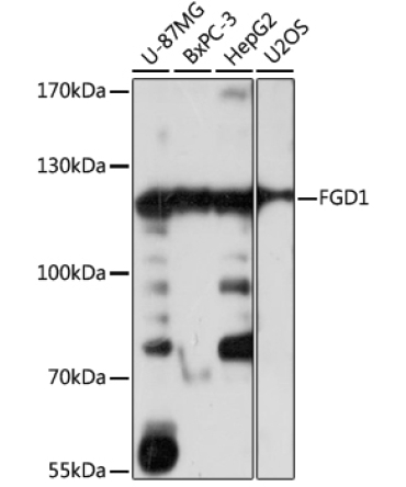 FGD1 Rabbit Polyclonal Antibody