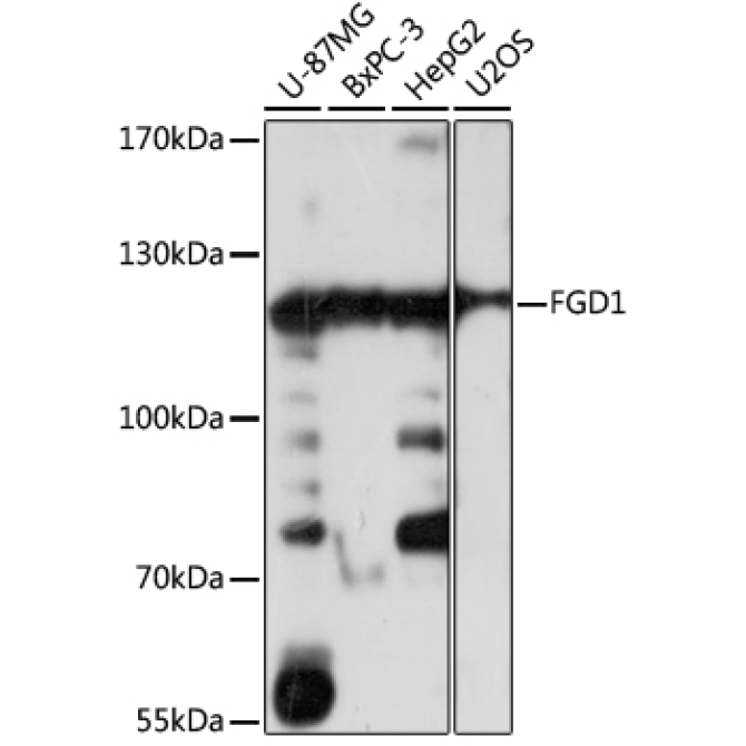 FGD1 Rabbit Polyclonal Antibody