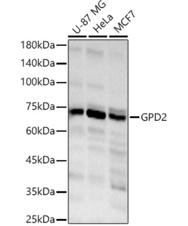 GPD2 Rabbit Polyclonal Antibody