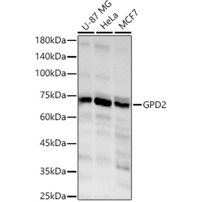 GPD2 Rabbit Polyclonal Antibody