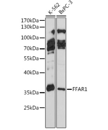 FFAR1 Rabbit Polyclonal Antibody