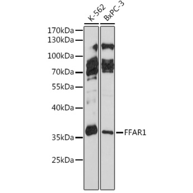 FFAR1 Rabbit Polyclonal Antibody