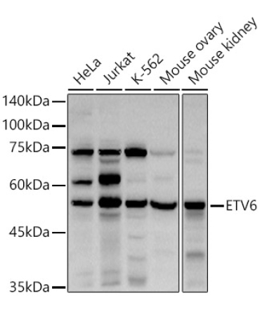 ETV6 Rabbit Polyclonal Antibody