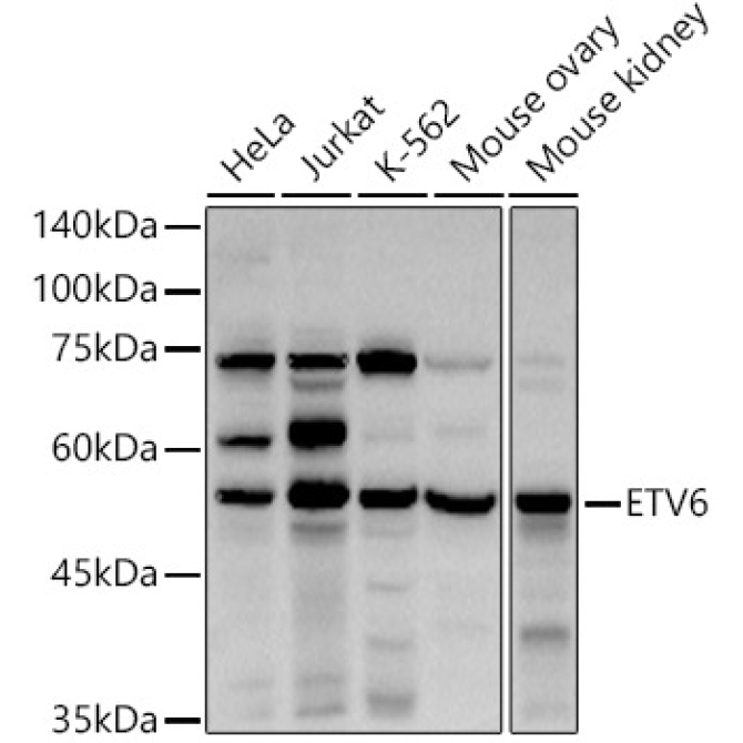 ETV6 Rabbit Polyclonal Antibody