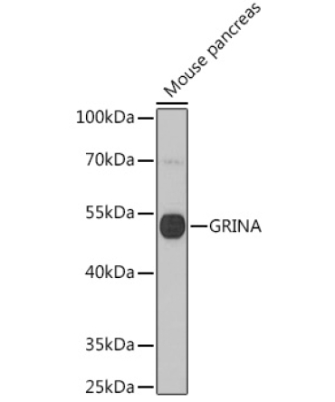 GRINA Rabbit Polyclonal Antibody