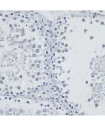 MSH6 Rabbit Polyclonal Antibody