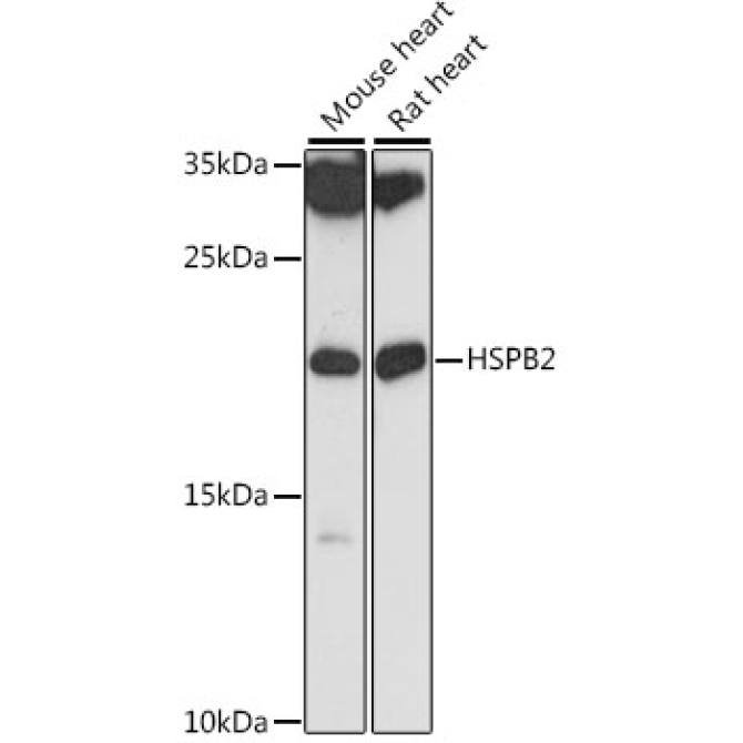 HSPB2 Rabbit Polyclonal Antibody