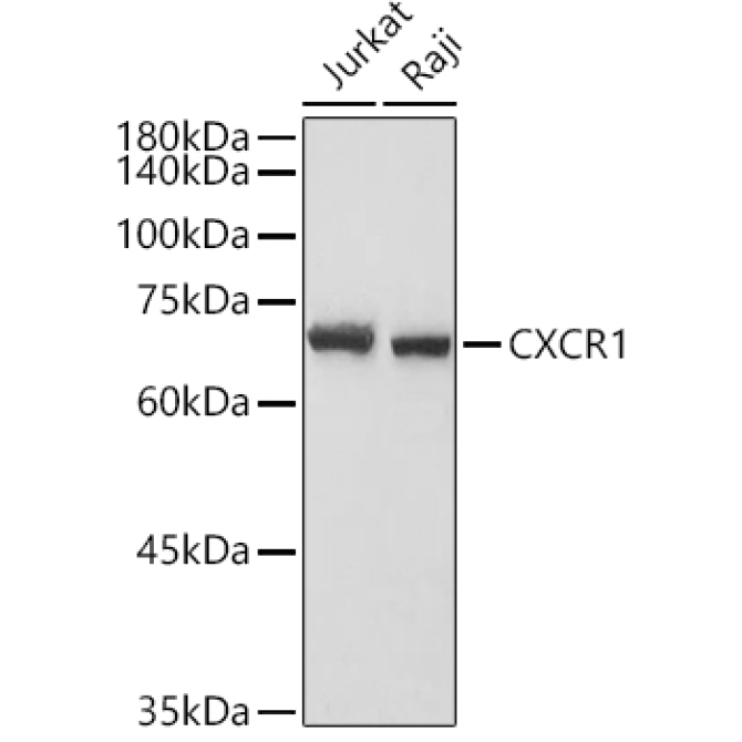 CXCR1 Rabbit Polyclonal Antibody