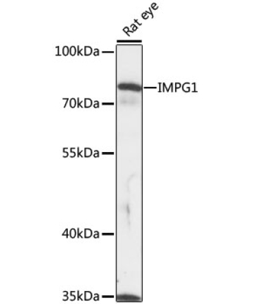 IMPG1 Rabbit Polyclonal Antibody
