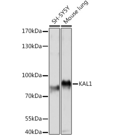 KAL1 Rabbit Polyclonal Antibody
