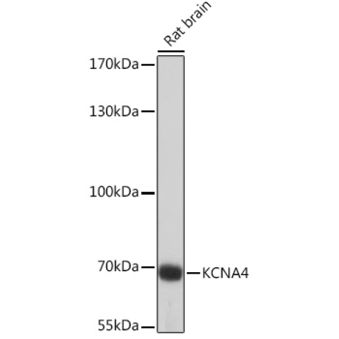 KCNA4 Rabbit Polyclonal Antibody